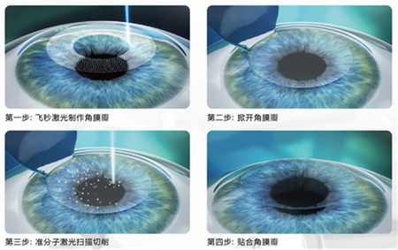 下半年,征兵,报名,开始,啦,近视,能,参军,吗, 下半年,征兵,报名,开始,啦,近视,能,参军,吗,